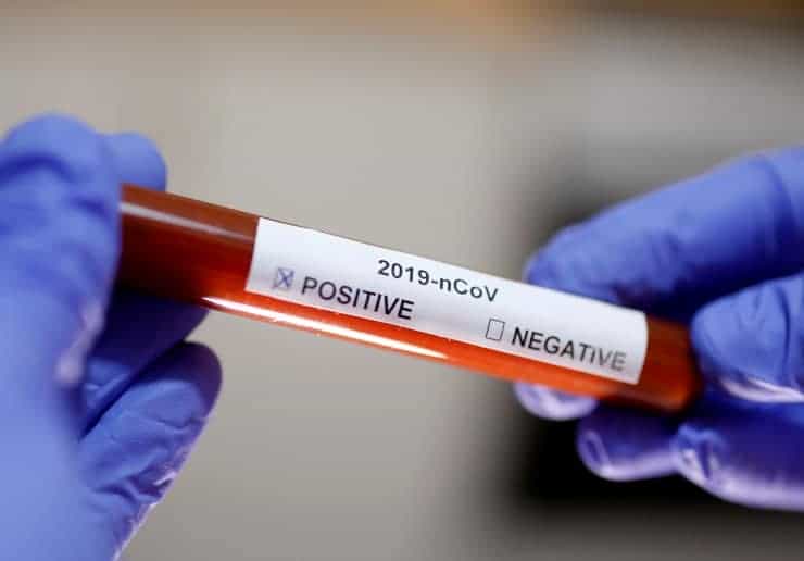 Türkiye’de ikinci Koronavirüs vakası tespit edildi